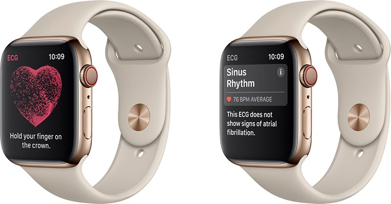 Apple Watch Series 4：発売中は心電図測定が米国に限定される（延期）