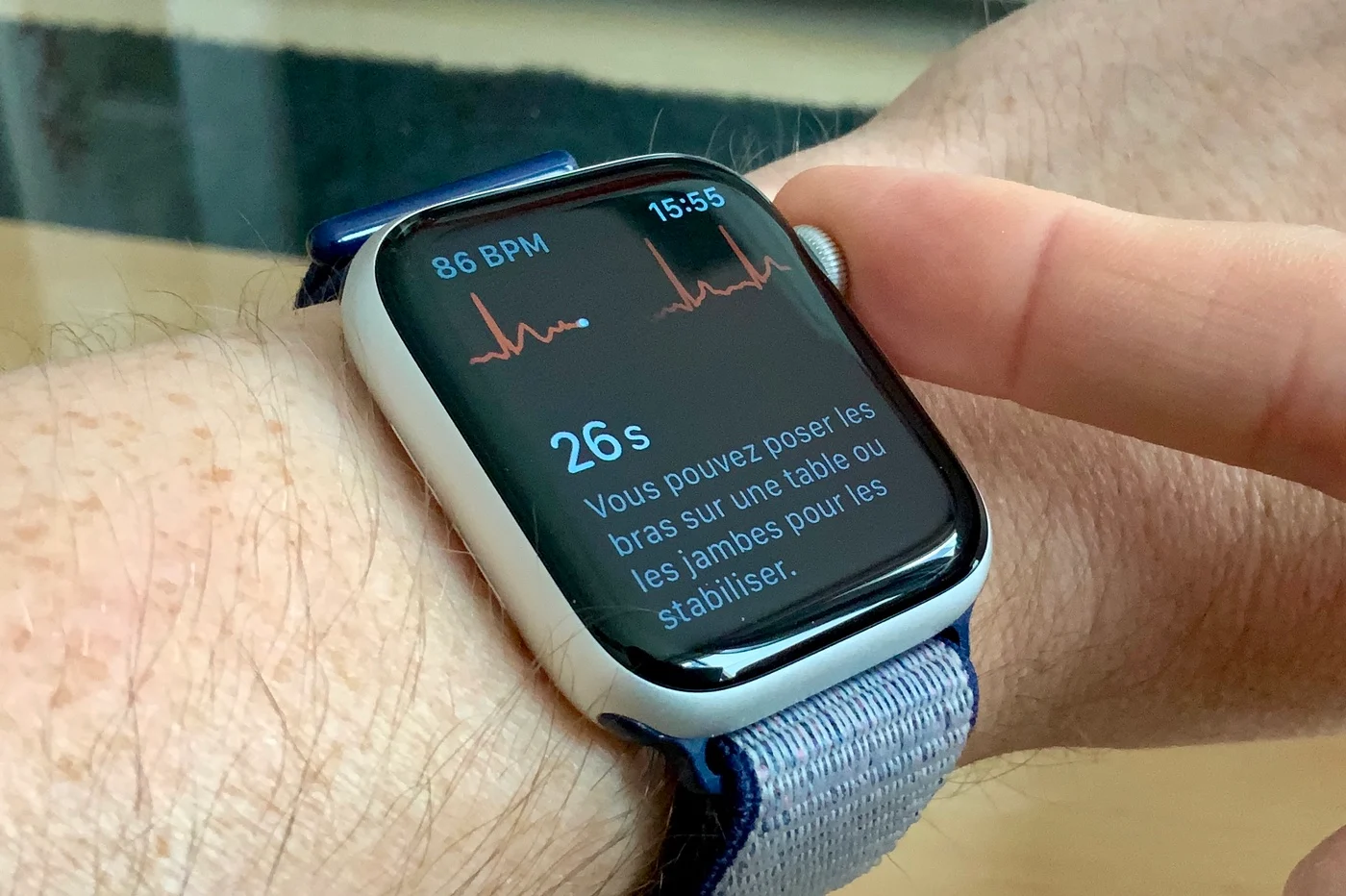 Apple WatchのECGは心臓発作を検出できるほど正確です